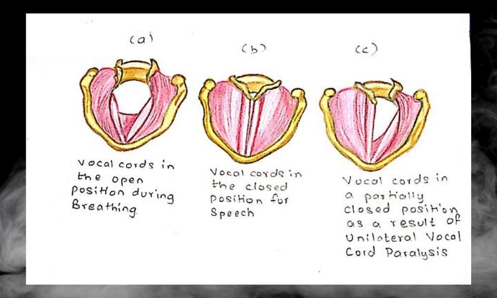 Vocal Cords - Are Vocals Considered as an Instrument 